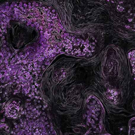 A scientist experimented on herself to treat her cancer. It worked