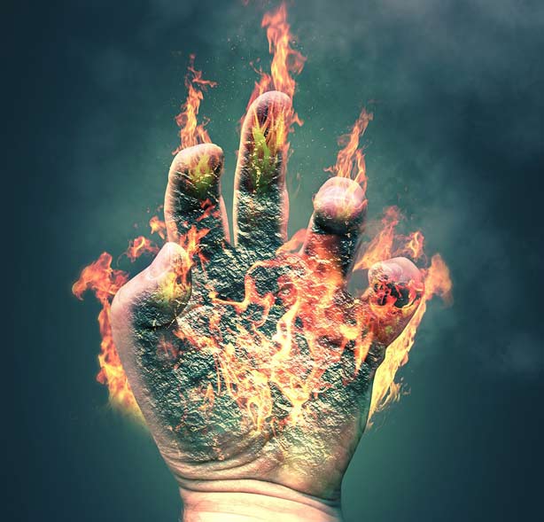 No, please don't put ice on your burns